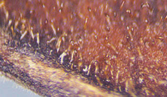 ヌスビトハギの果実表面の毛