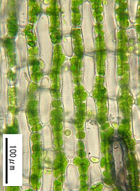 アラハシラガゴケの葉身細胞