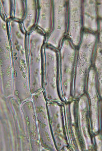 キンシゴケの葉身細胞