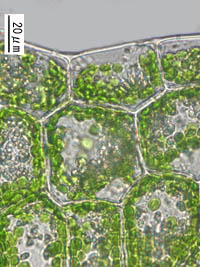 クモノスゴケモドキの葉縁細胞