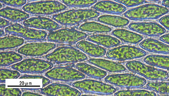リボンゴケ葉身細胞