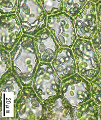 ウロコゴケの葉身細胞