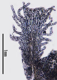 ハマネナシカズラ花冠の鱗片