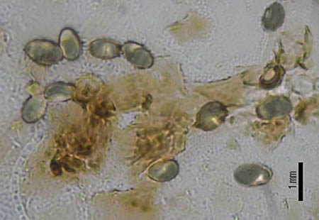ミカワクロアミアシイグチ胞子