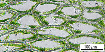 アブラゴケ葉身細胞