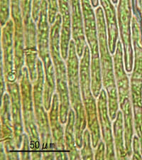 ナガハシゴケの葉身細胞
