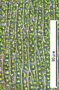 アカイチイゴケの葉身細胞