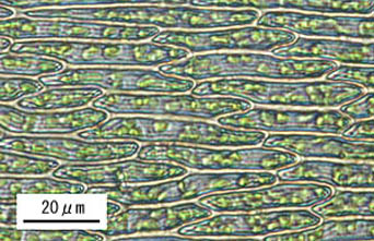 アオギヌゴケ葉身細胞