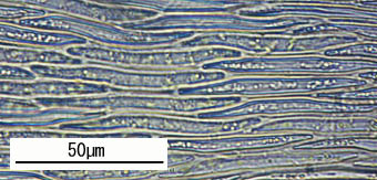 アラハヒツジゴケの葉身細胞