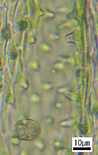 エダウロコゴケモドキの葉細胞のパピラ