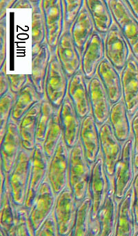 エダウロコゴケモドキの葉身細胞