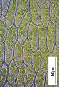 エゾハリガネゴケの葉身細胞