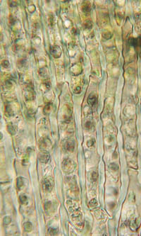 エゾスナゴケの葉の基部の細胞
