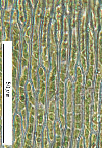 ハイゴケの葉身細胞