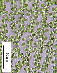 ハリガネゴケの葉身細胞