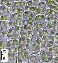 ヘラハネジレゴケの葉身細胞