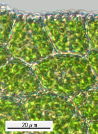 アカイチイゴケの葉身細胞パピラ