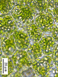 ヒメトサカゴケの葉細胞