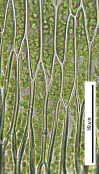 ヒモヒツジゴケ葉身細胞