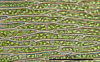 ヒロハツヤゴケの葉身細胞