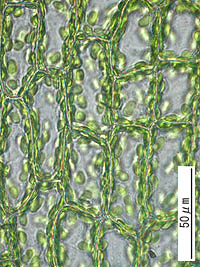 ヒロクチゴケの葉身細胞