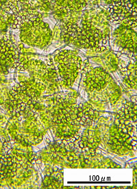 ホソバミズゼニゴケの葉身細胞