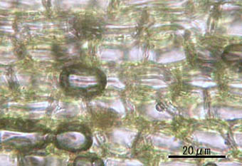 ホソバオキナゴケ葉身細胞