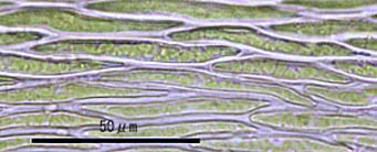 ホソミツヤゴケ葉身細胞