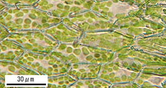 ホソウリゴケの葉細胞