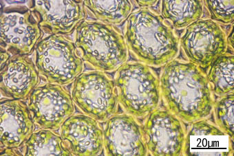 フルノコゴケ葉身細胞