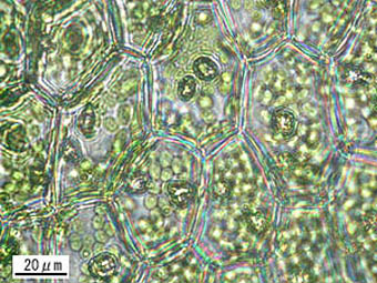 フソウツキヌキゴケの葉身細胞