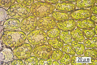 カラヤスデゴケ葉身細胞