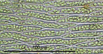 ケヘチマゴケ葉身細胞