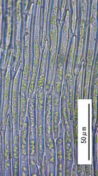 ケヒツジゴケの葉身細胞