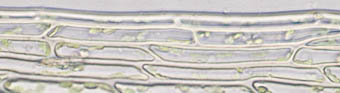 キンシゴケの葉縁の葉身細胞