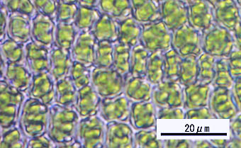 コバノイトゴケ葉身細胞