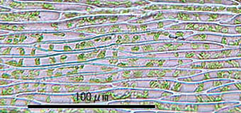 コカヤゴケ葉身細胞