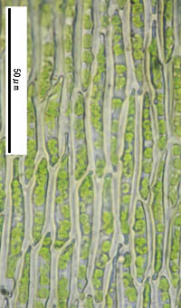 コクシノハゴケ葉身細胞