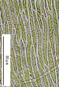 アコモチイトゴケの葉身細胞