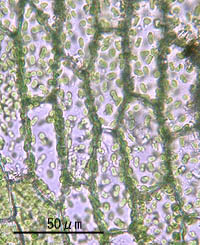 コツリガネゴケの葉身細胞