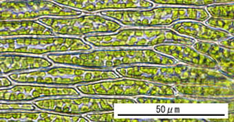 コウヤノマンネングサの葉身細胞