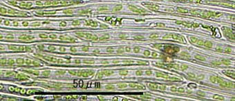 クシノハゴケ葉身細胞