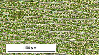 ミヤマサナダゴケ葉身細胞