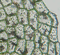 ミズゼニゴケモドキ葉縁の細胞