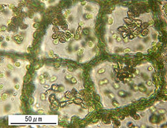 ミズゼニゴケモドキ葉状体細胞