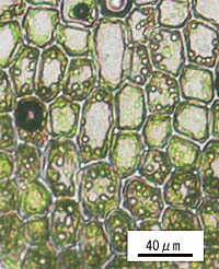 ムチゴケの腹葉の細胞