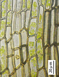 ナガバチヂレゴケの葉下部の細胞