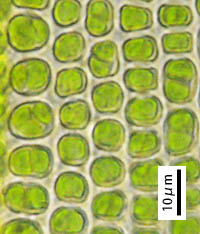 ナガバチヂレゴケの葉中部の細胞