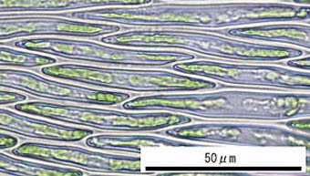 ナガヒツジゴケ葉身細胞