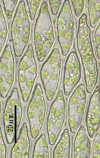 ネズミノオゴケの葉身細胞